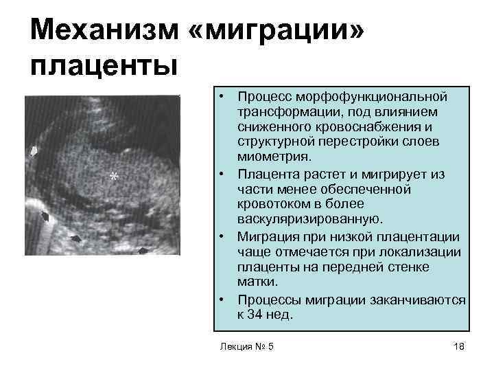 Механизм «миграции» плаценты  • Процесс морфофункциональной   трансформации, под влиянием  