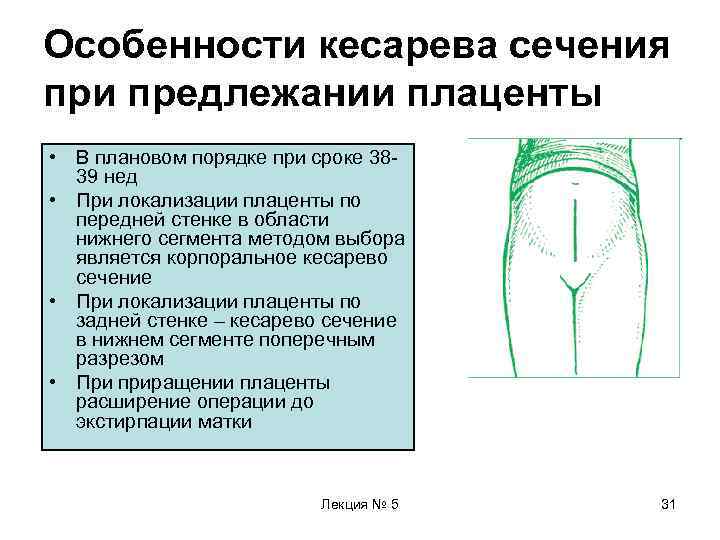 Особенности кесарева сечения при предлежании плаценты • В плановом порядке при сроке 38 -