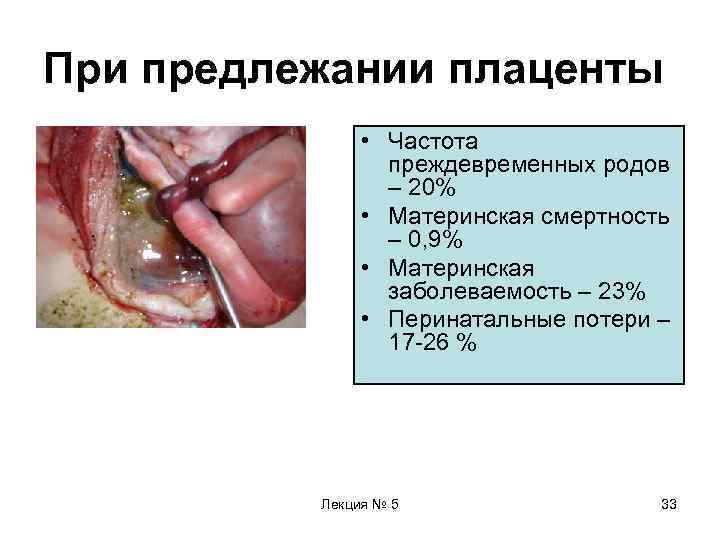 При предлежании плаценты   • Частота   преждевременных родов   –