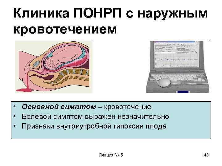 Клиника ПОНРП с наружным кровотечением • Основной симптом – кровотечение • Болевой симптом выражен