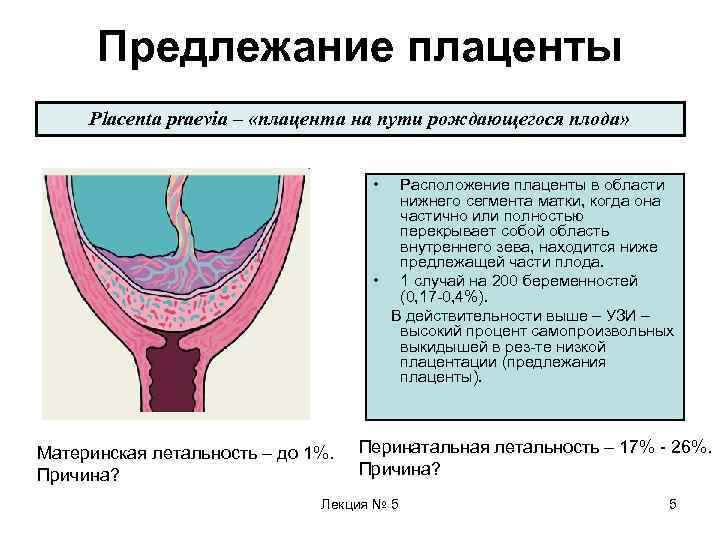 Тест предлежание плаценты