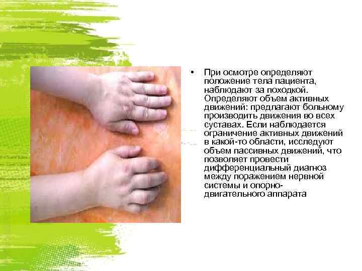  •  При осмотре определяют положение тела пациента, наблюдают за походкой. Определяют объем