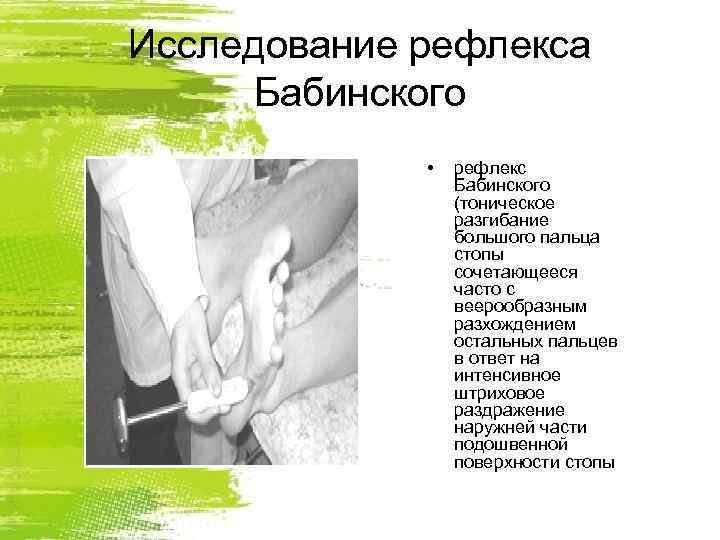 Исследование рефлекса Бабинского    •  рефлекс   Бабинского  