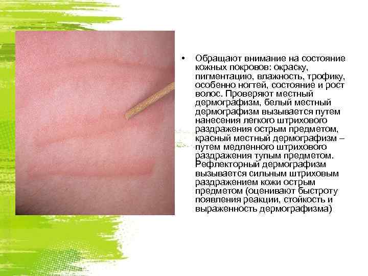  •  Обращают внимание на состояние кожных покровов: окраску, пигментацию, влажность, трофику, особенно