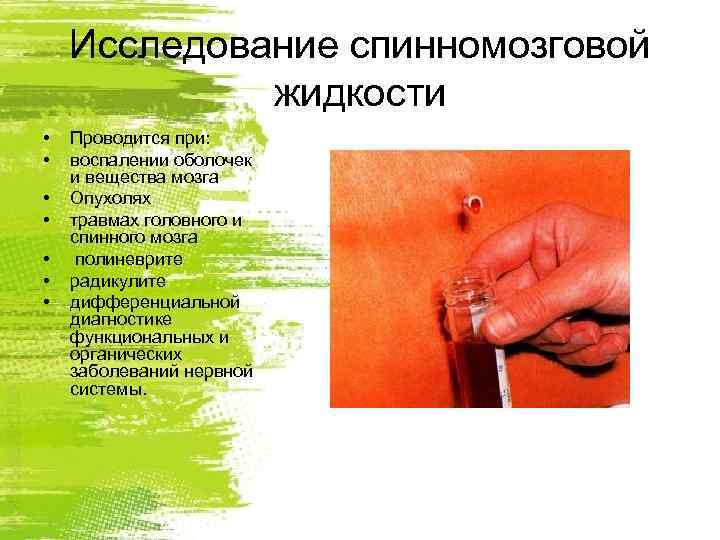   Исследование спинномозговой   жидкости •  Проводится при:  • 