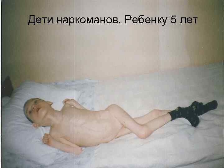 Дети наркоманов. Ребенку 5 лет Дети наркоманов. Ребенку 5 лет