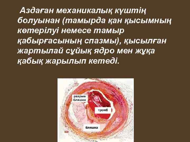 Аздаған механикалық күштің болуынан (тамырда қан қысымның көтерілуі немесе тамыр қабырғасының спазмы), қысылған жартылай