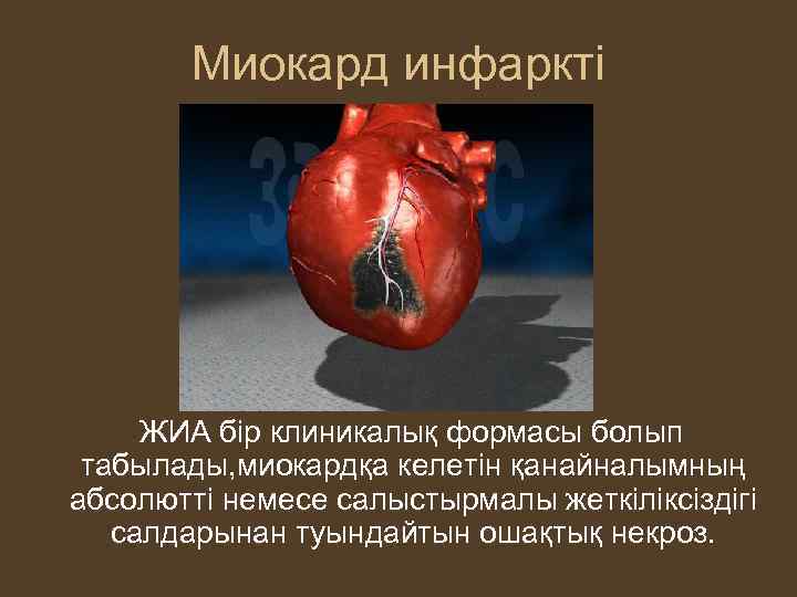 Миокард инфаркті ЖИА бір клиникалық формасы болып табылады, миокардқа келетін қанайналымның абсолютті немесе салыстырмалы