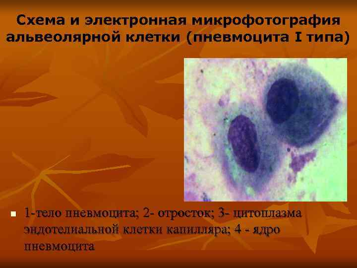  Схема и электронная микрофотография альвеолярной клетки (пневмоцита I типа) n  1 -тело