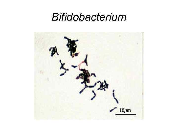 Bifidobacterium 