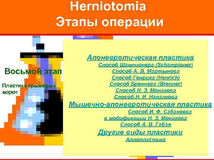    Herniotomia   Этапы операции     Апоневротическая пластика