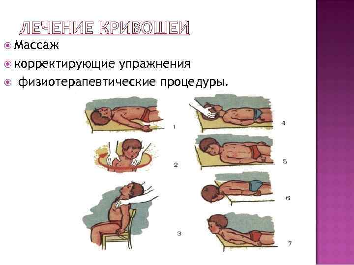  Массаж  корректирующие  упражнения физиотерапевтические процедуры. 