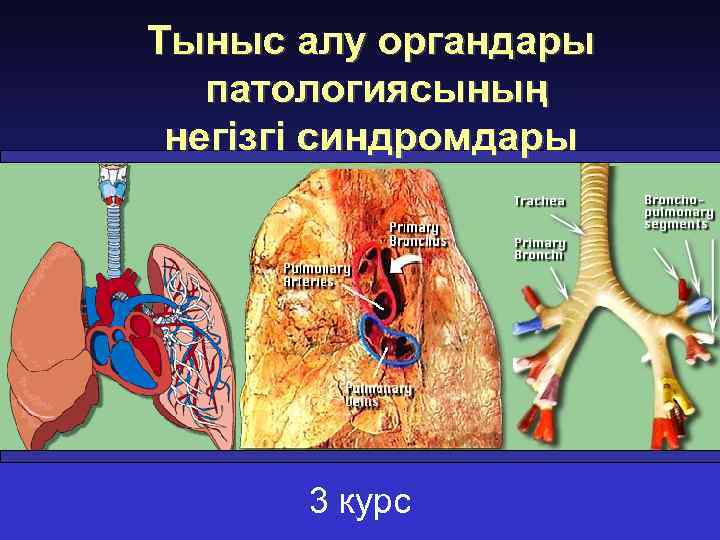 Тыныс алу органдары патологиясының негізгі синдромдары 3 курс 