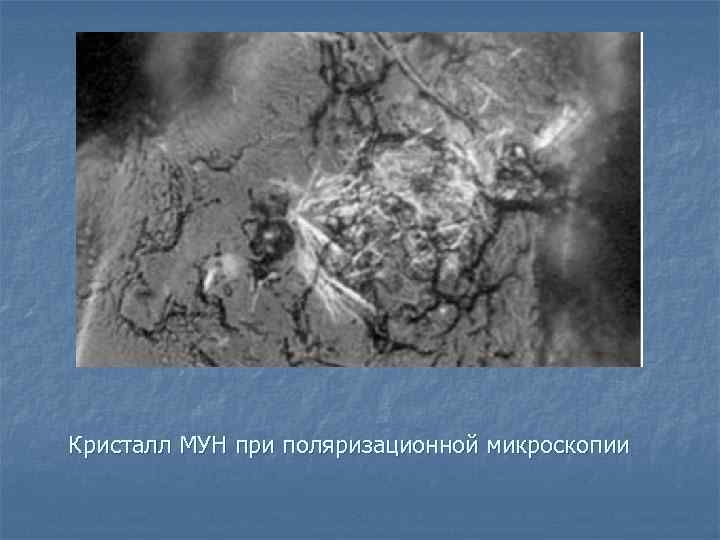 Кристалл МУН при поляризационной микроскопии 
