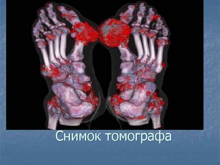 Снимок томографа 