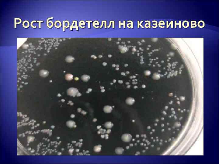 Рост бордетелл на казеиново  -угольном агаре 