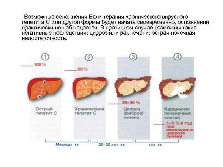  Возможные осложнения Если терапия хронического вирусного гепатита С или другой формы будет начата