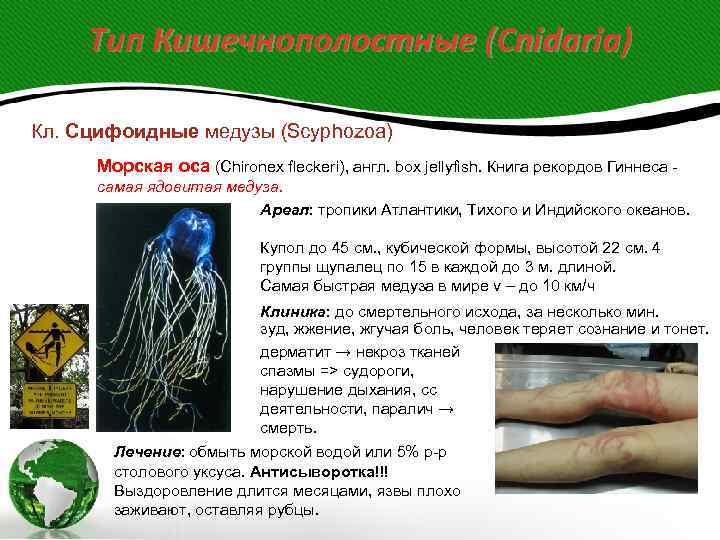  Тип Кишечнополостные (Cnidaria) Кл. Сцифоидные медузы (Scyphozoa)  Морская оса (Chironex fleckeri), англ.
