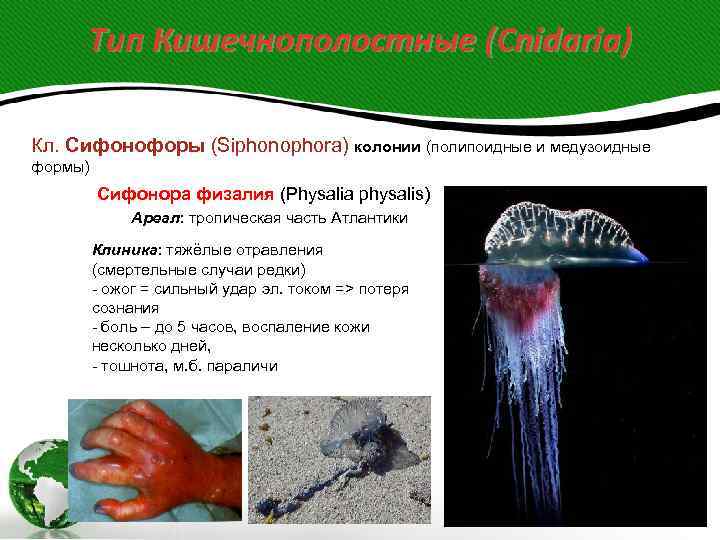  Тип Кишечнополостные (Cnidaria) Кл. Сифонофоры (Siphonophora) колонии (полипоидные и медузоидные формы)  Cифонора
