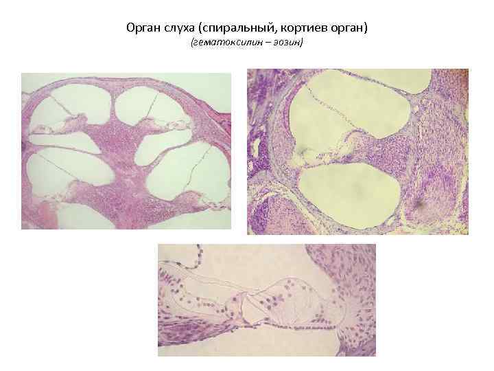 Орган слуха (спиральный, кортиев орган) (гематоксилин – эозин) 