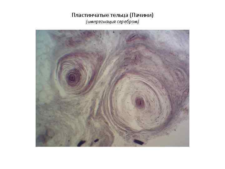 Пластинчатые тельца (Пачини) (импрегнация серебром) 