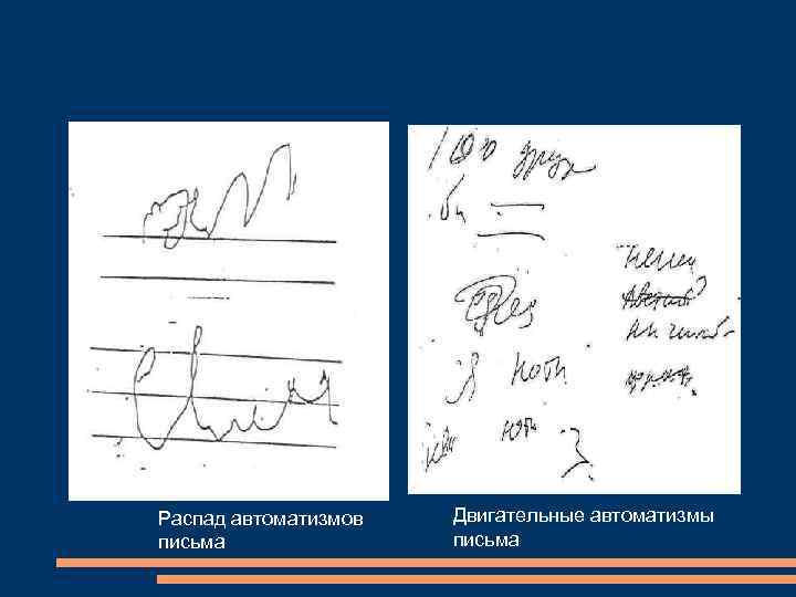 Распад автоматизмов Двигательные автоматизмы письма Распад автоматизмов Двигательные автоматизмы письма
