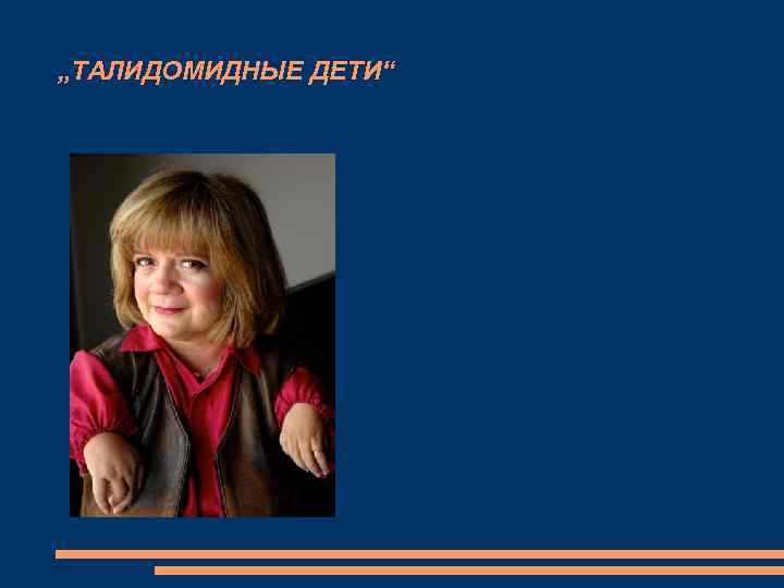 „ТАЛИДОМИДНЫЕ ДЕТИ“ 