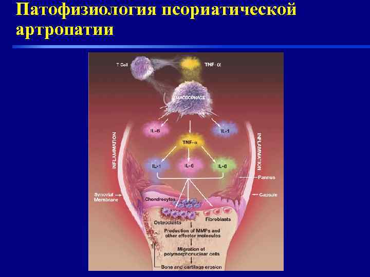 Патофизиология псориатической артропатии 