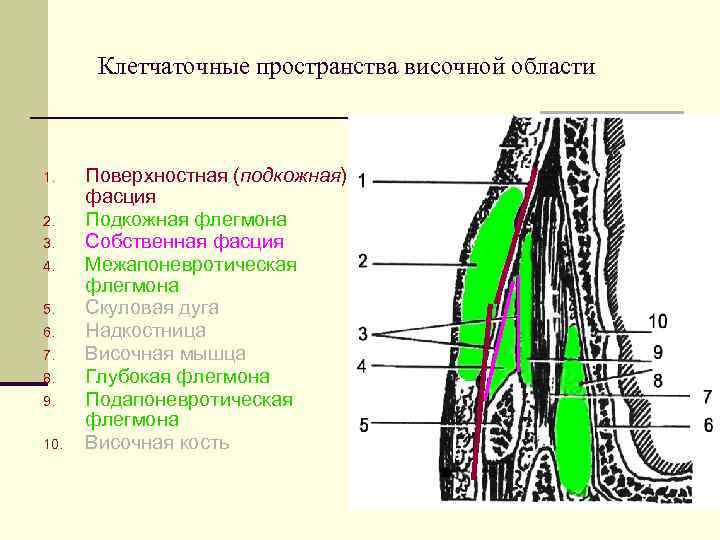   Клетчаточные пространства височной области  1. Поверхностная (подкожная)  фасция 2. Подкожная
