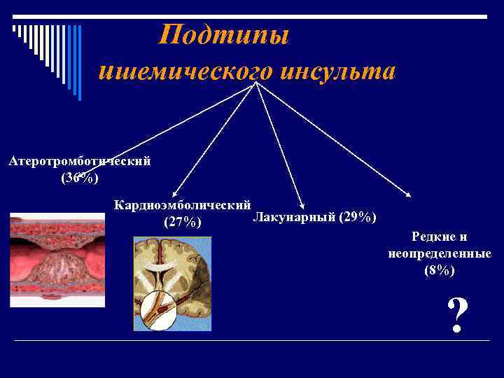 План обследования при ишемическом инсульте