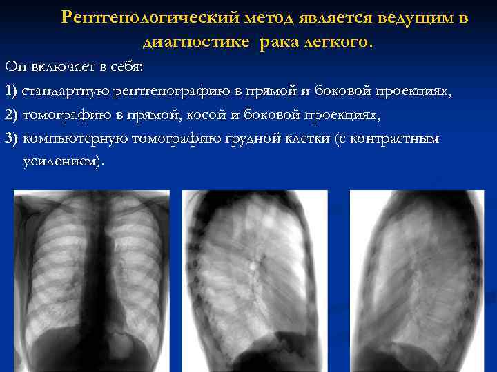 Рак легкого карта вызова смп