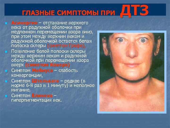   ГЛАЗНЫЕ СИМПТОМЫ ПРИ    ДТЗ n  Асинергия – отставание