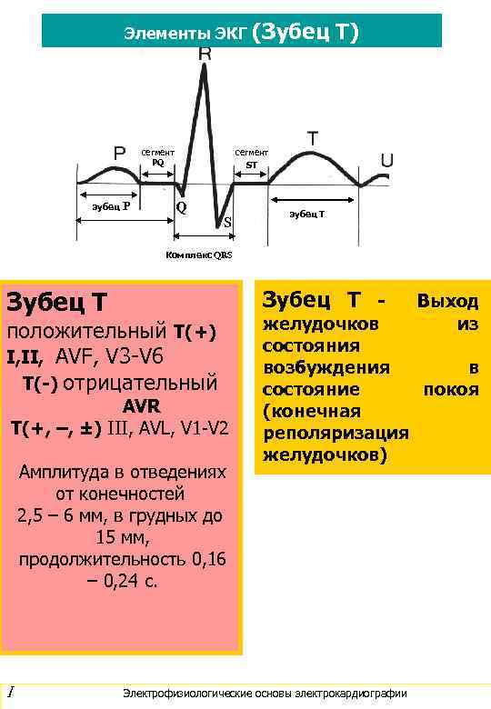 Сглажена т на экг