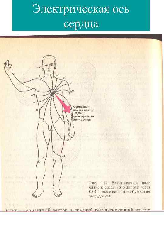 Электрическая ось сердца 