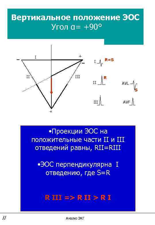 Вертикальное положение ЭОС Угол α= +90° _ + _ I III R=S R II
