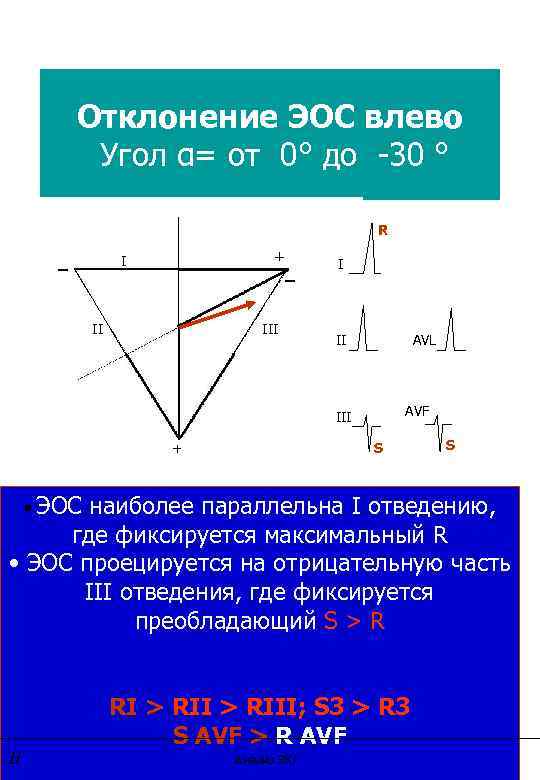 Отклонение ЭОС влево Угол α= от 0° до -30 ° R _ + _