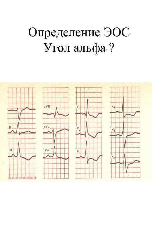 Определение ЭОС Угол альфа ? 