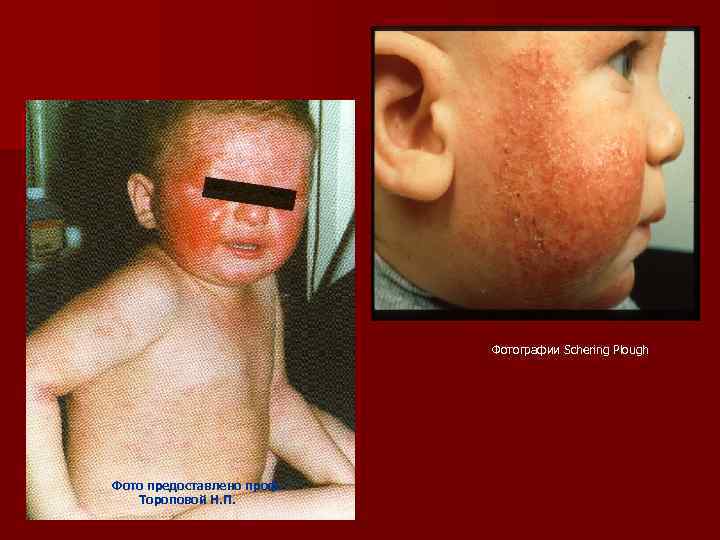 Фотографии Schering Plough Фото предоставлено проф. Тороповой Н. П. 