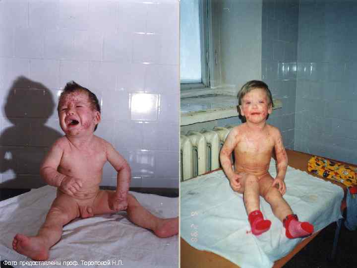 Фото предоставлены проф. Тороповой Н. П. 