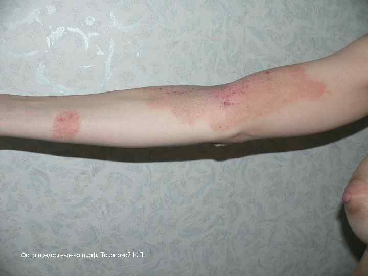 Фото предоставлено проф. Тороповой Н. П. 