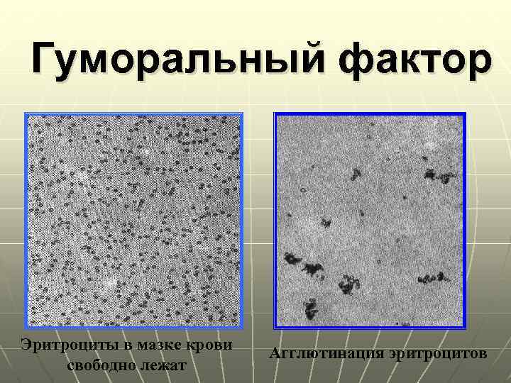 Гуморальный фактор Эритроциты в мазке крови свободно лежат Агглютинация эритроцитов 