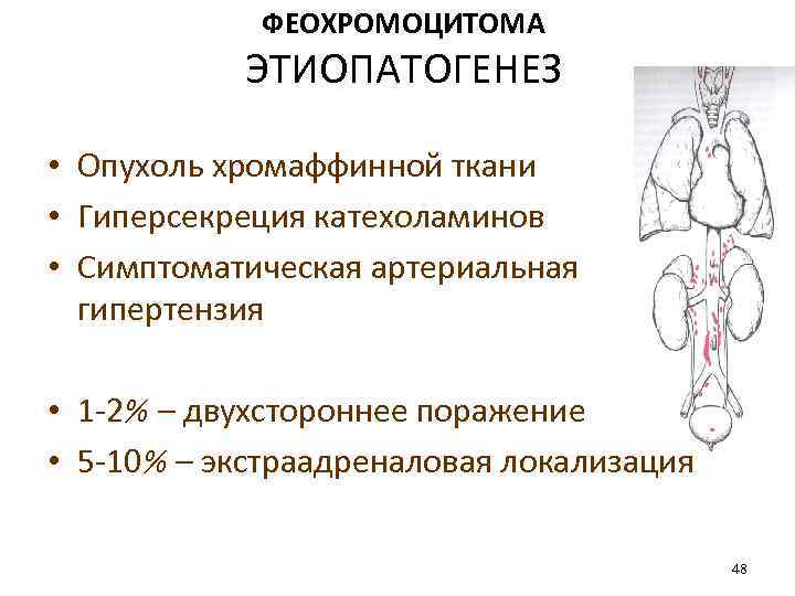 ФЕОХРОМОЦИТОМА ЭТИОПАТОГЕНЕЗ • Опухоль хромаффинной ткани • Гиперсекреция катехоламинов • Симптоматическая артериальная гипертензия •