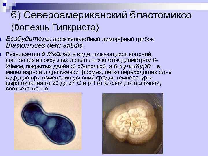 n n б) Североамериканский бластомикоз (болезнь Гилкриста) Возбудитель: дрожжеподобный диморфный грибок Blastomyces dermatitidis. Развивается