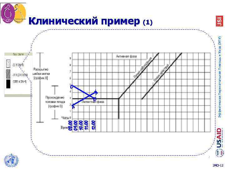 Партограмма в акушерстве как заполнять образец заполнения