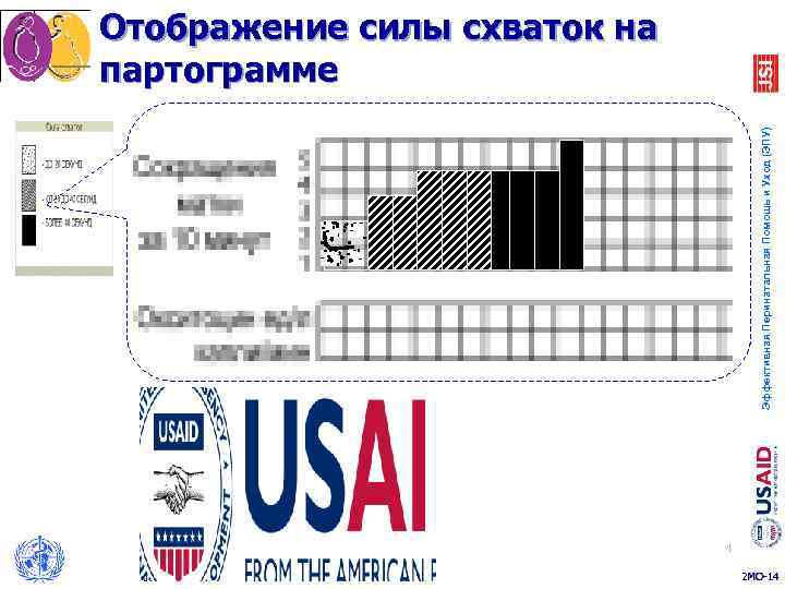 Отображение силы схваток на партограмме       Эффективная Перинатальная Помощь