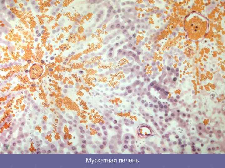 Мускатная печень 