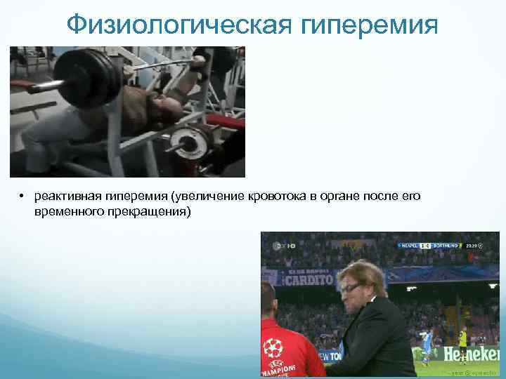 Физиологическая гиперемия • реактивная гиперемия (увеличение кровотока в органе после его временного прекращения) 