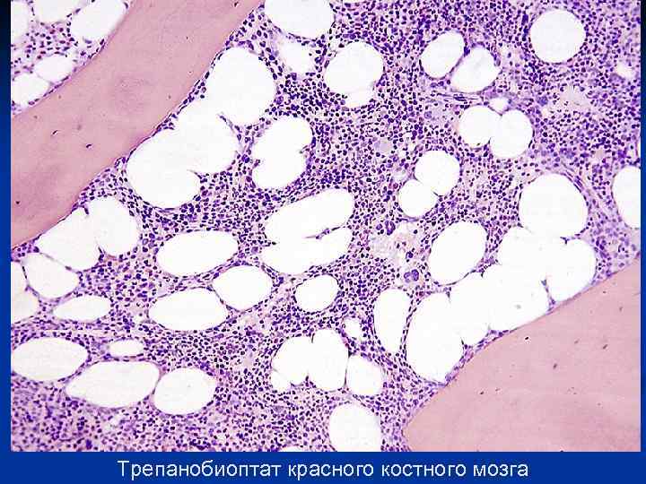 Красный мозг препарат. Срез красного костного мозга гистология. Красный костный мозг гистология препарат. Миелоидная ткань красного костного мозга. Миелоидная ткань (красный костный мозг) гистология.