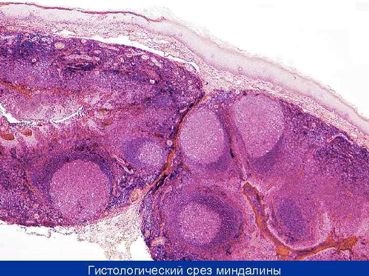 Гистологический срез миндалины 
