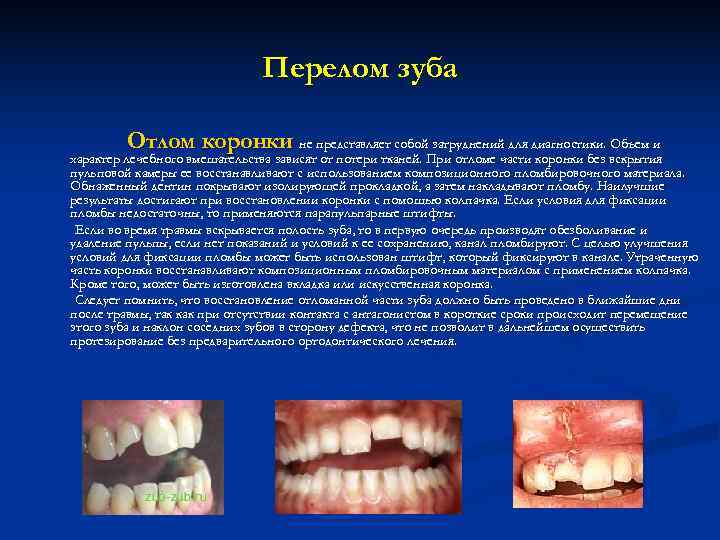 Травма зубов презентация